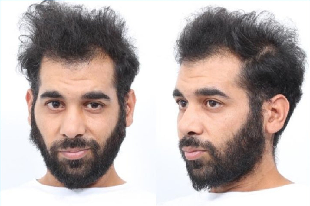 Hollandsk Politi efterlyser den 33-årige Ergün Senarabaci som mistænkt for drab på to personer i en biograf i Gronningen. Politifoto.